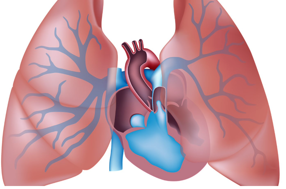 Academic Half Day: Pulmonary Hypertension