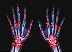 Academic Half Day: Rheumatology Emergencies