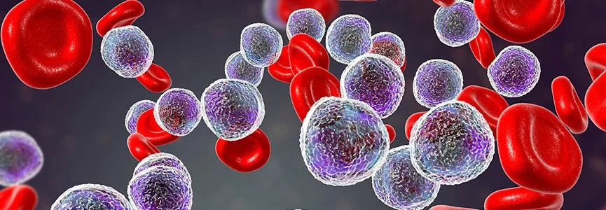Academic Half Day: Malignant Heme