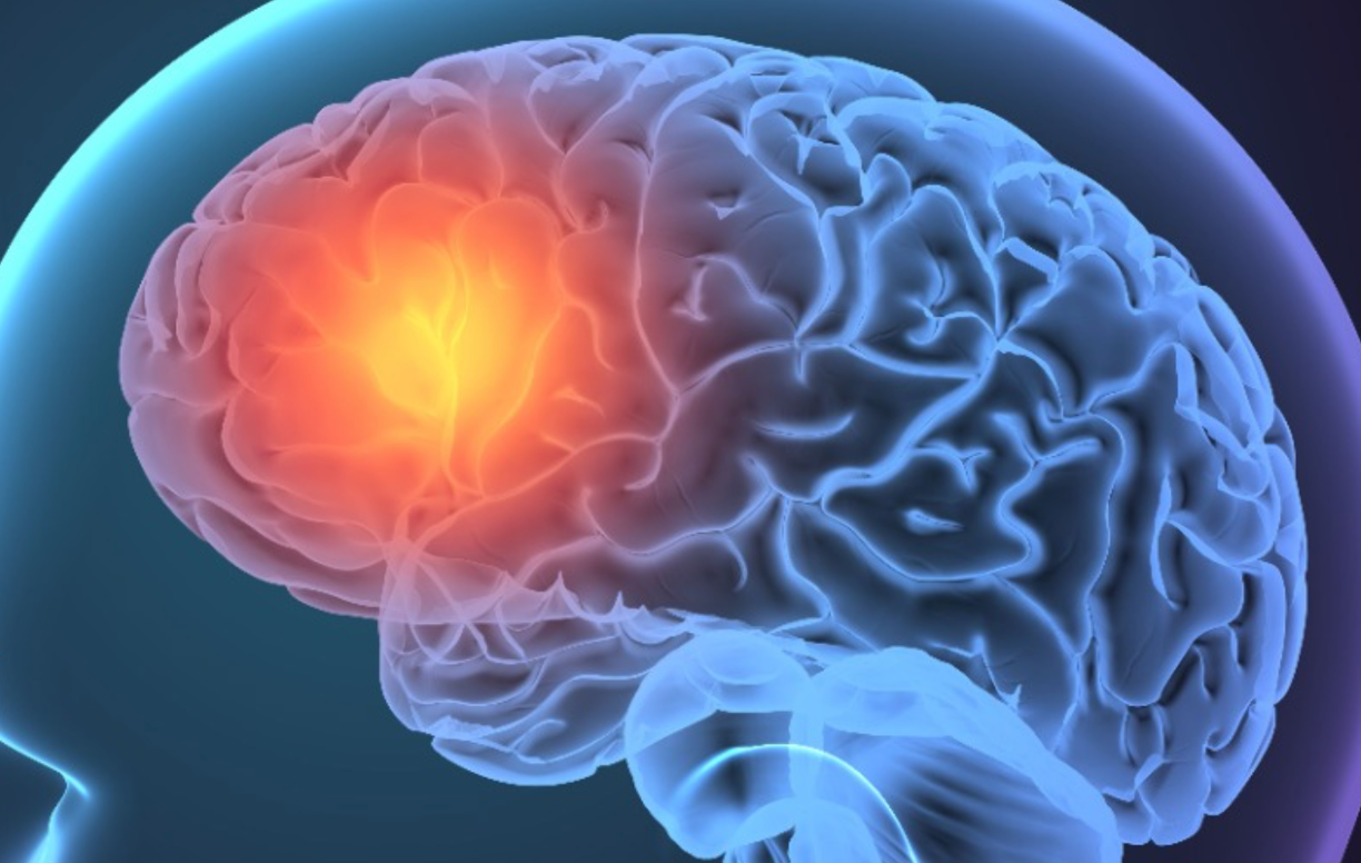 Academic Half Day: Neuro Emergencies