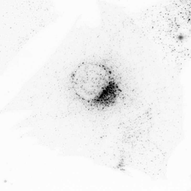 This MC3t3-E1 mouse cell was subjected to a chemical to induce ER stress, then stained to label the lysosomes.