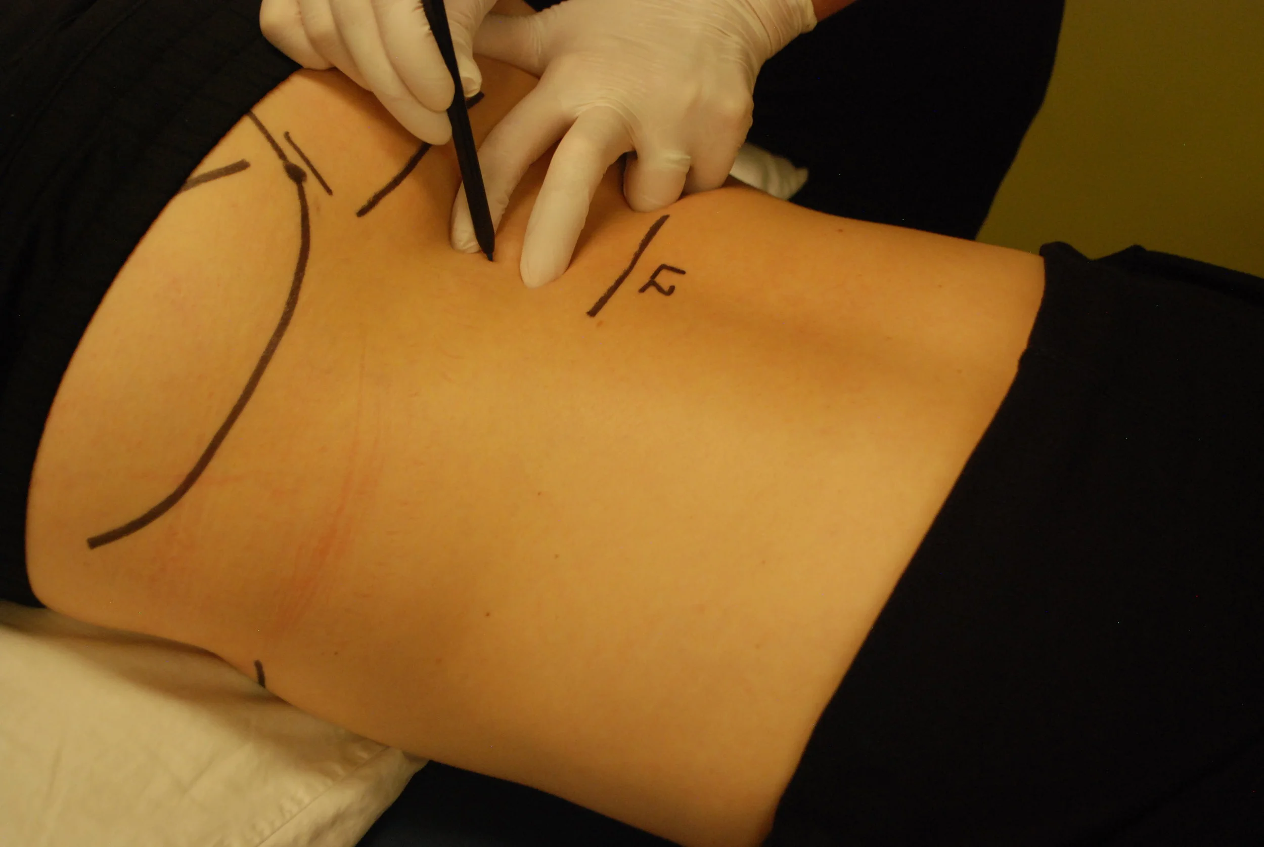 l-spinetechnique.jpg