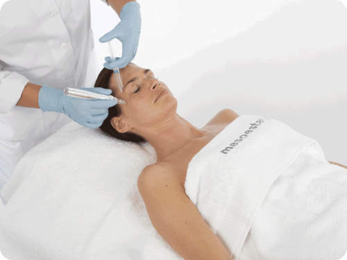 m.pen-PRO-treatment-V2-500x375.png