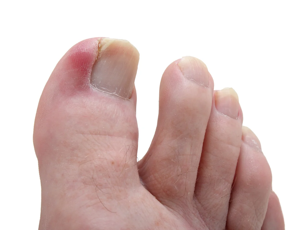Rose Bay Podiatry Podiatrist Eastern suburbs. Sally Belcher Sarah Bongioletti Medi-Pedi Flat Feet Functional assessments Nail treatments Custom made orthotics Podiatry for kids Keryflex nail restoration Ingrown toenail treatments Fungal nail treatments Diabetes assessments Nail surgery Home visits