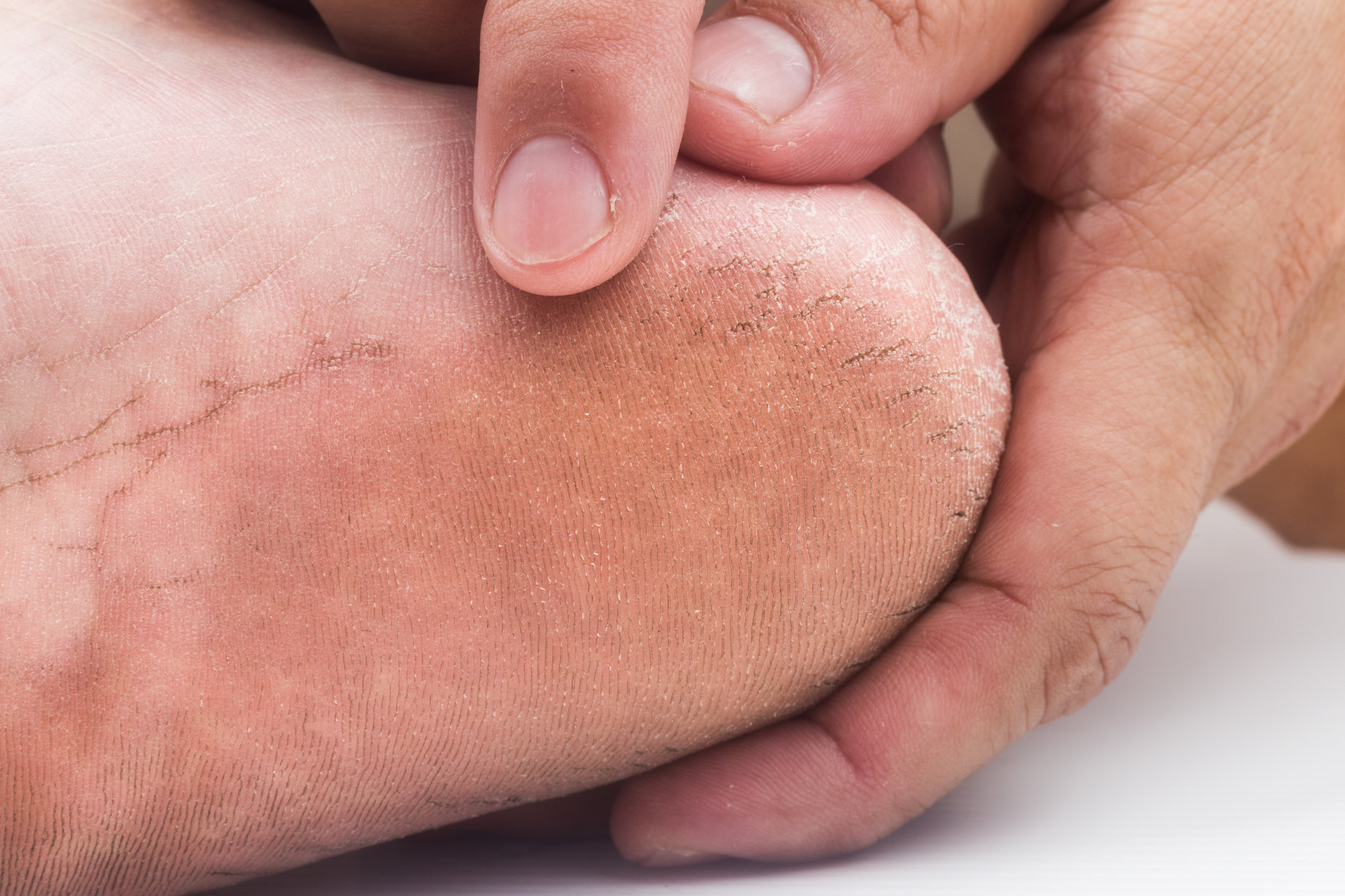 Rose Bay Podiatry Podiatrist Eastern suburbs. Sally Belcher Sarah Bongioletti Medi-Pedi Flat Feet Functional assessments Nail treatments Custom made orthotics Podiatry for kids Keryflex nail restoration Ingrown toenail treatments Fungal nail treatments Diabetes assessments Nail surgery Home visits