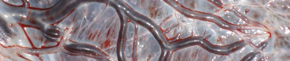 Pre-labour Rupture of Membranes: impatience and risk