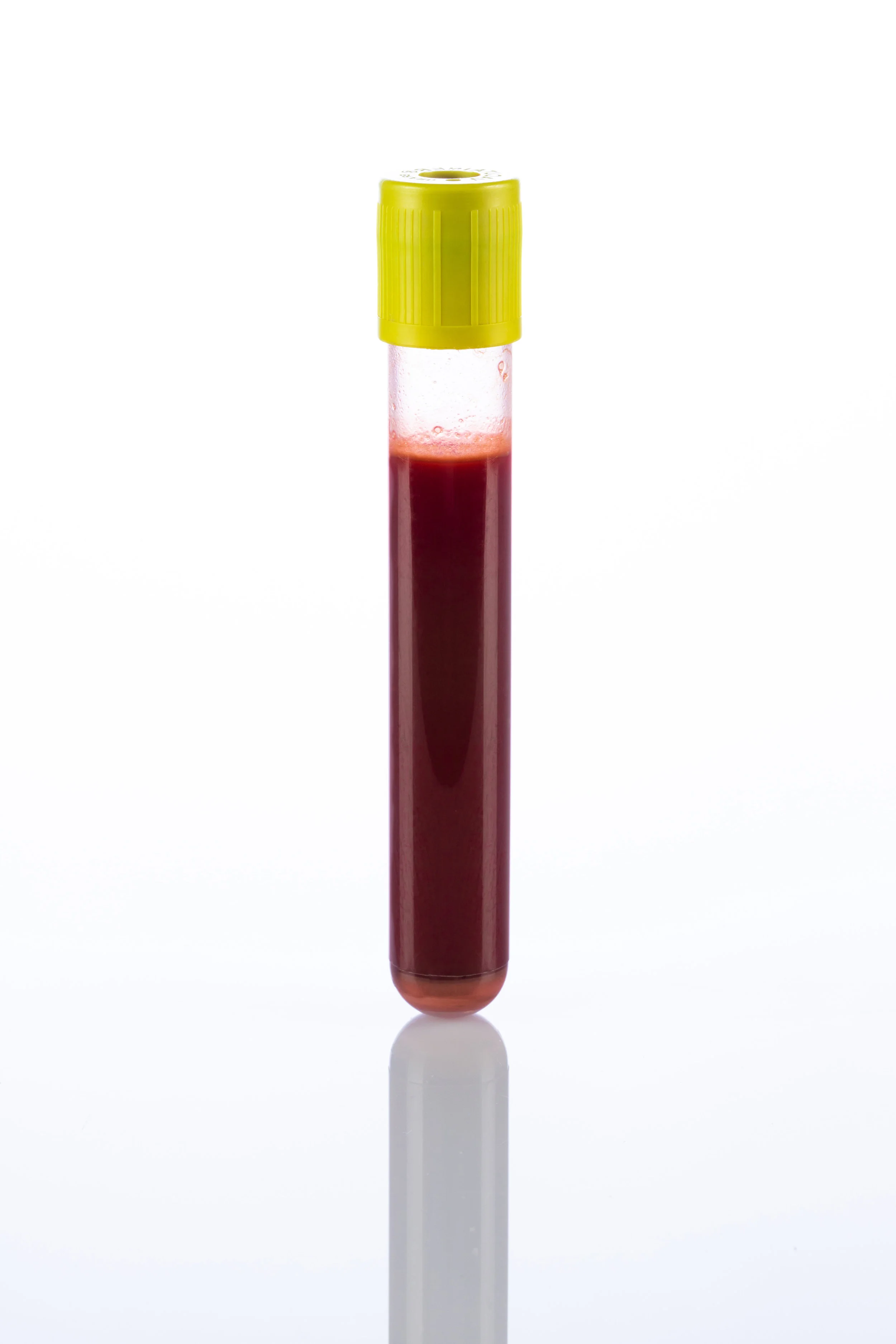 86_Nicole Depaoli_Perchè ce l'ho nel sangue_Progetto Aula 3_IED Torino+VANNI occhiali.jpg