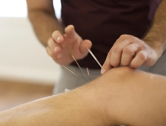 acupunture1.jpeg