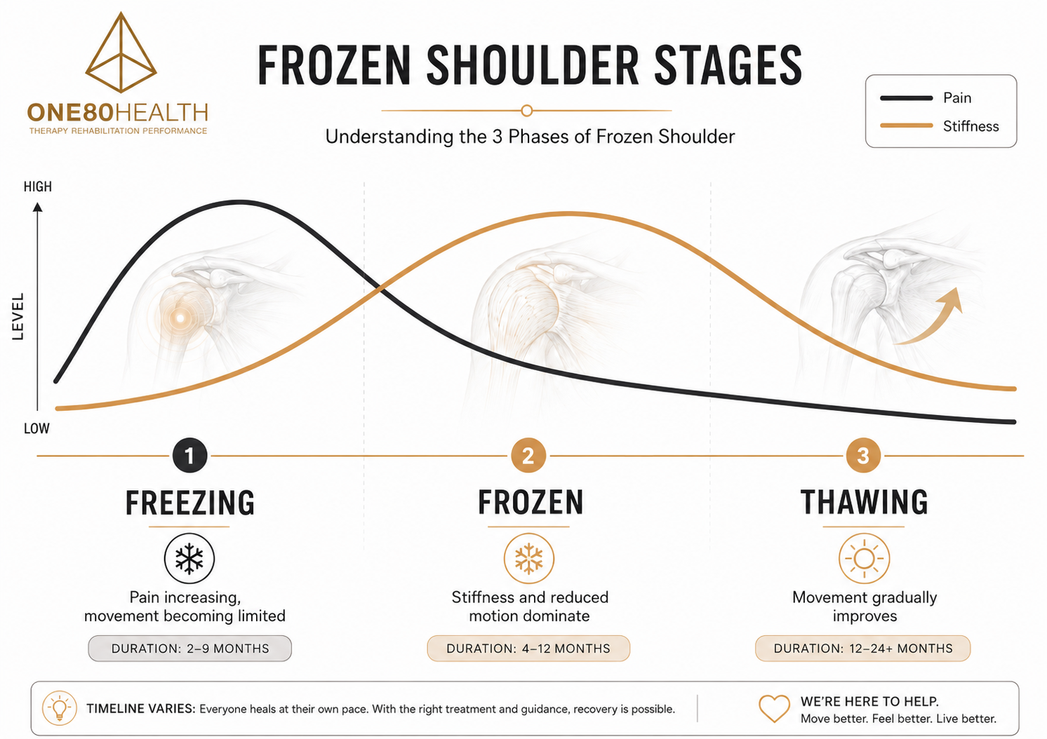 Infographic showing the freezing, frozen, and thawing stages of frozen shoulder with pain and stiffness timelines.