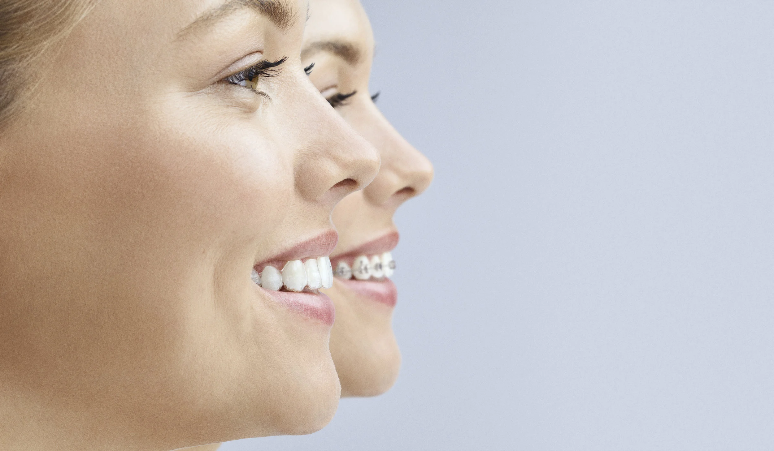 invisalign-side-by-side.jpg