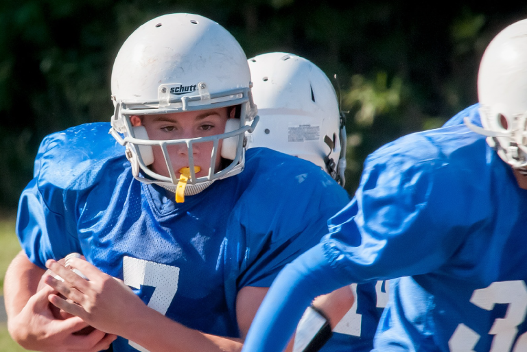 Mouthguard-Blog.png
