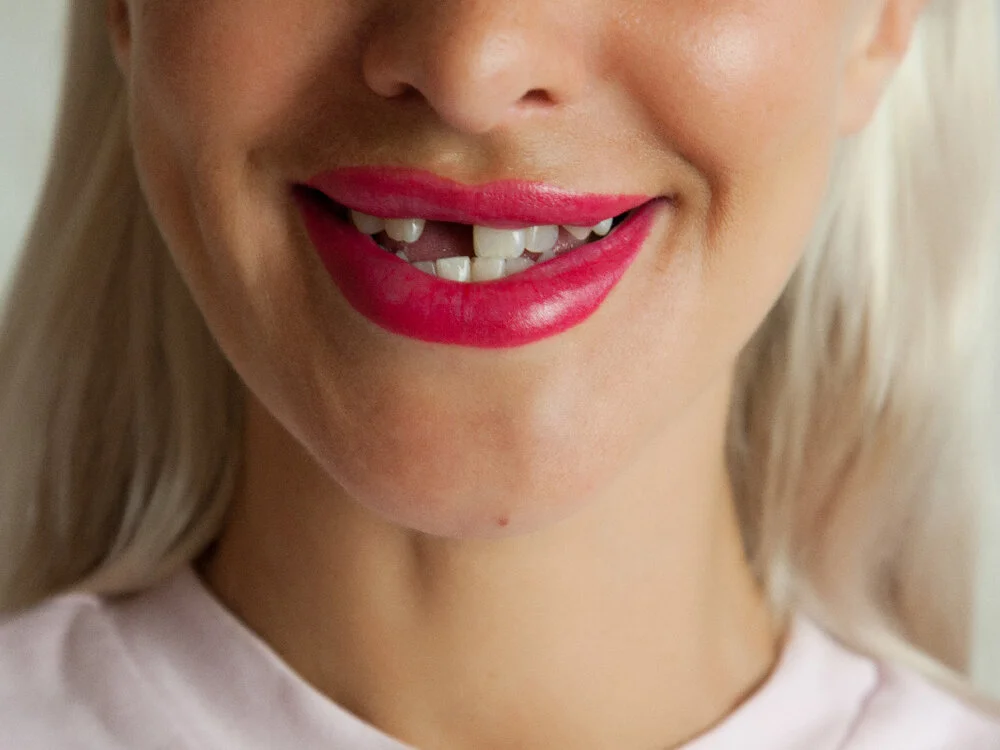 09_VACEK_DENTALIMPLANTCANDIDATE_BLOG.jpg