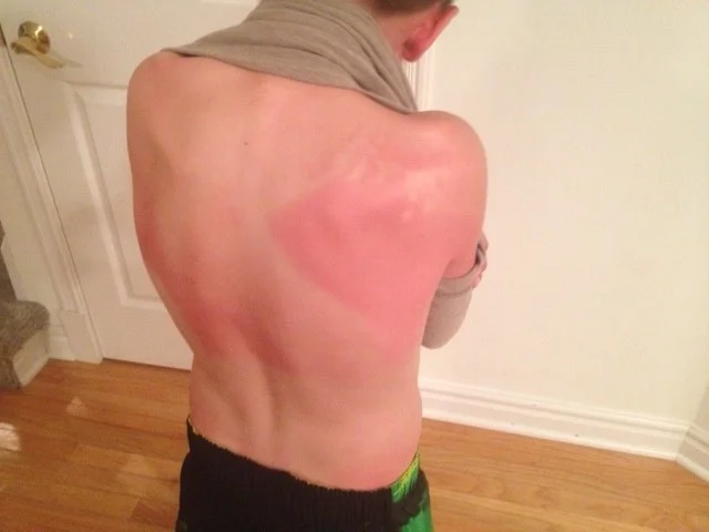sunscreen.jpg