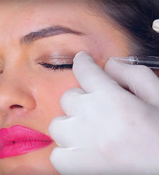 The Best Time to Get Botox: Our Favorite Stories of the Week