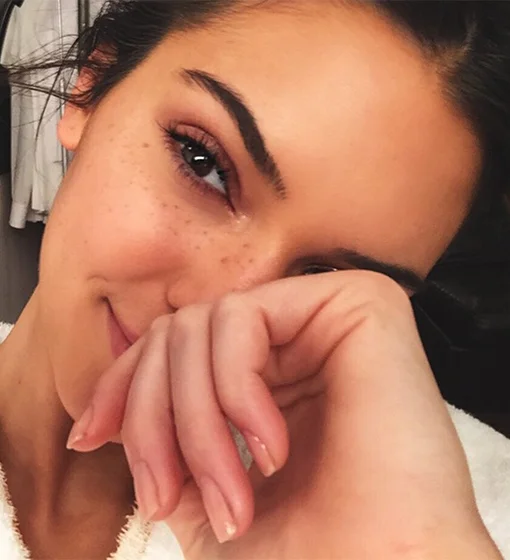 How Kendall Jenner Got Rid of Her Acne: Our Favorite Stories of the Week