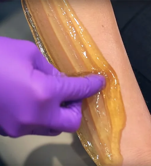 Sugaring: The Best Hair Removal Treatment?