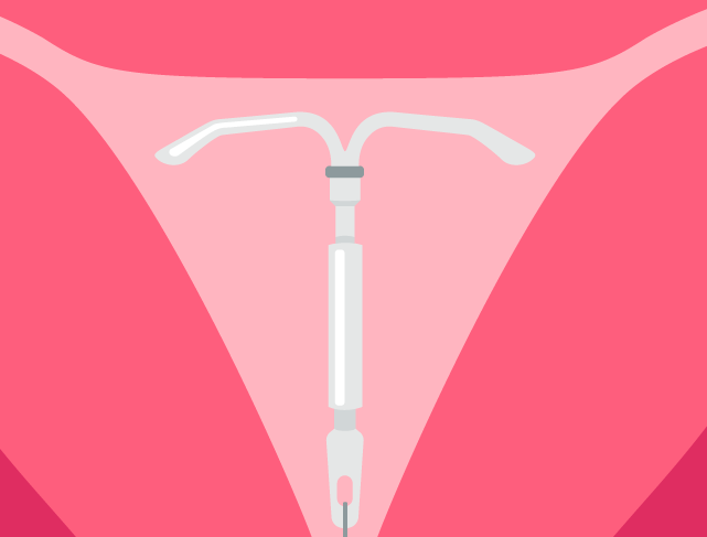 What's the Best IUD? My Experience With Mirena