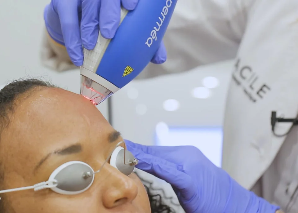 Here's A Skin-Smoothing Laser Treatment That Works with All Skin Tones and Types