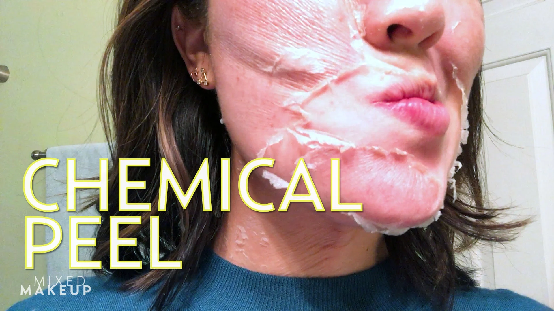 How To Care For Your skin After A Perfect Derma Chemical Peel