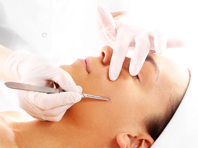 Here's What To Expect From A Dermaplaning Treatment