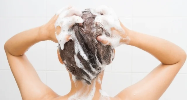 Reddit Loves This Dandruff Shampoo and Here’s Why