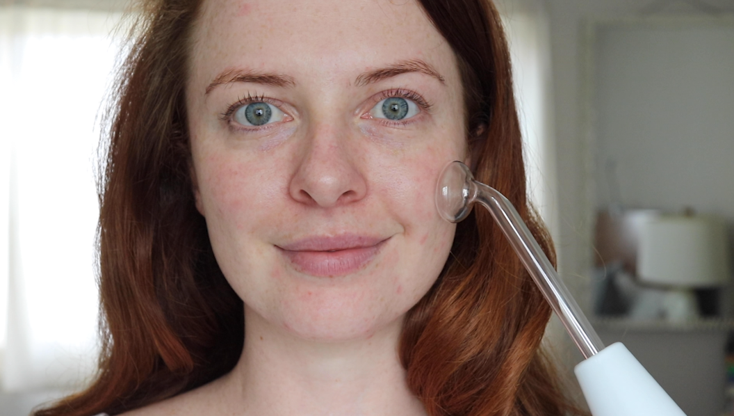 Are High-Frequency Treatments the Acne Cure We've Been Waiting For?