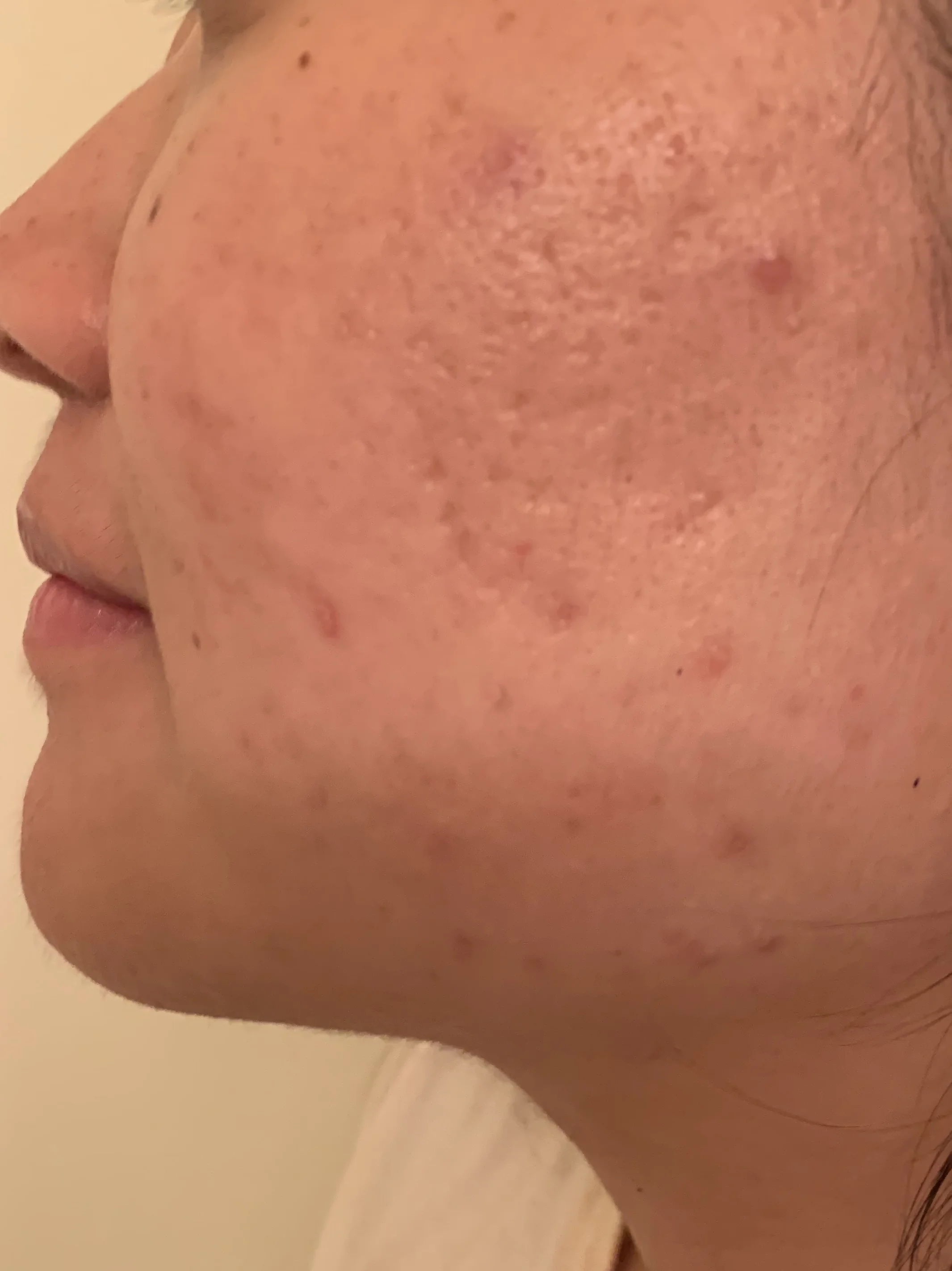 After the first month