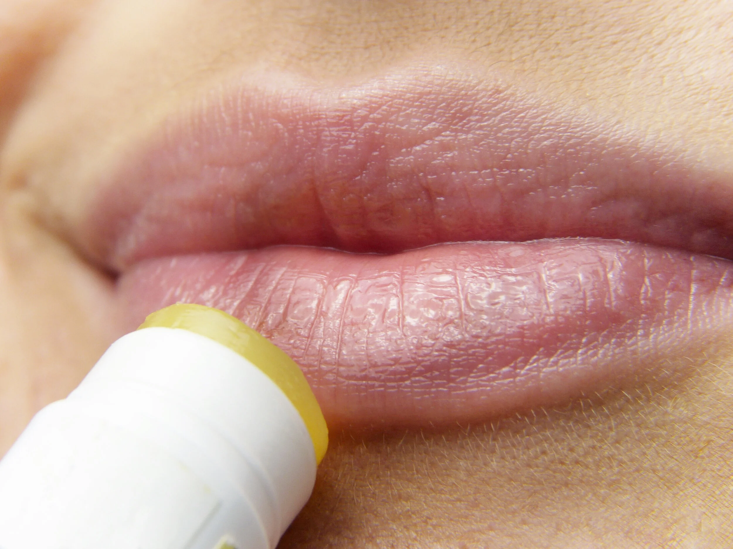 The Most Recommended Lip Balms in the Mixed Makeup Facebook Group