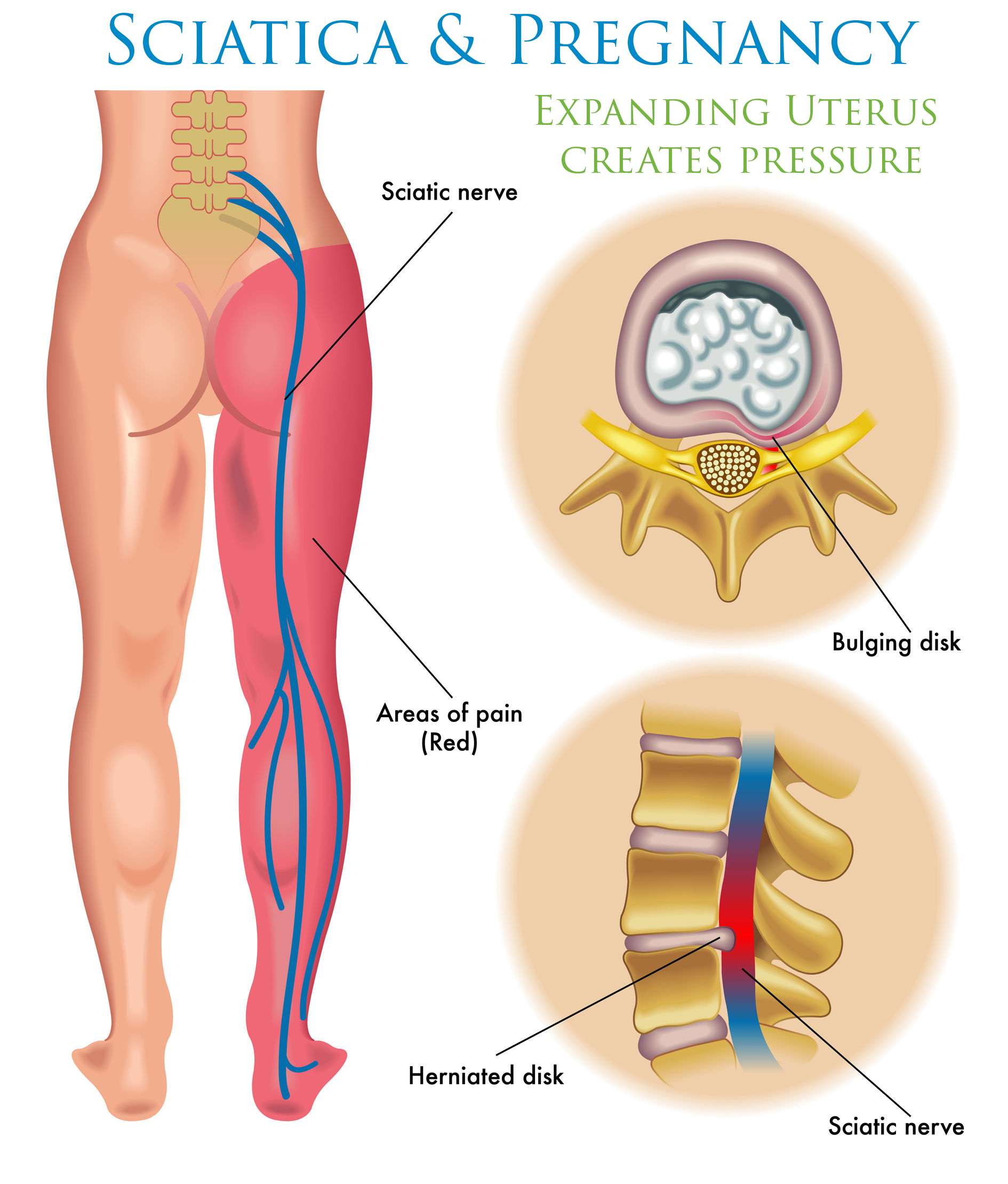 Anatomy of a woman's expanding uterus