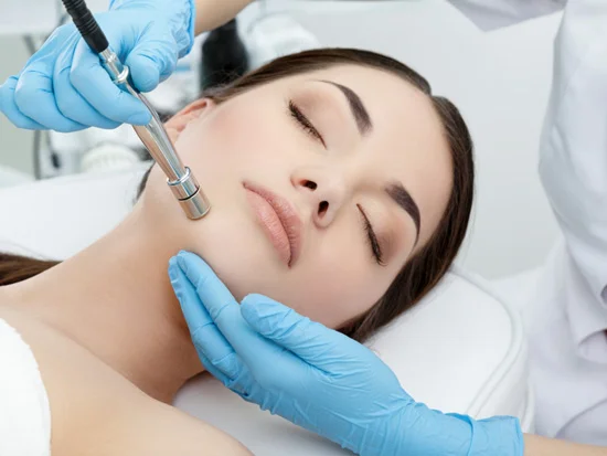 microdermabrasion-58f62bf56547c.jpg