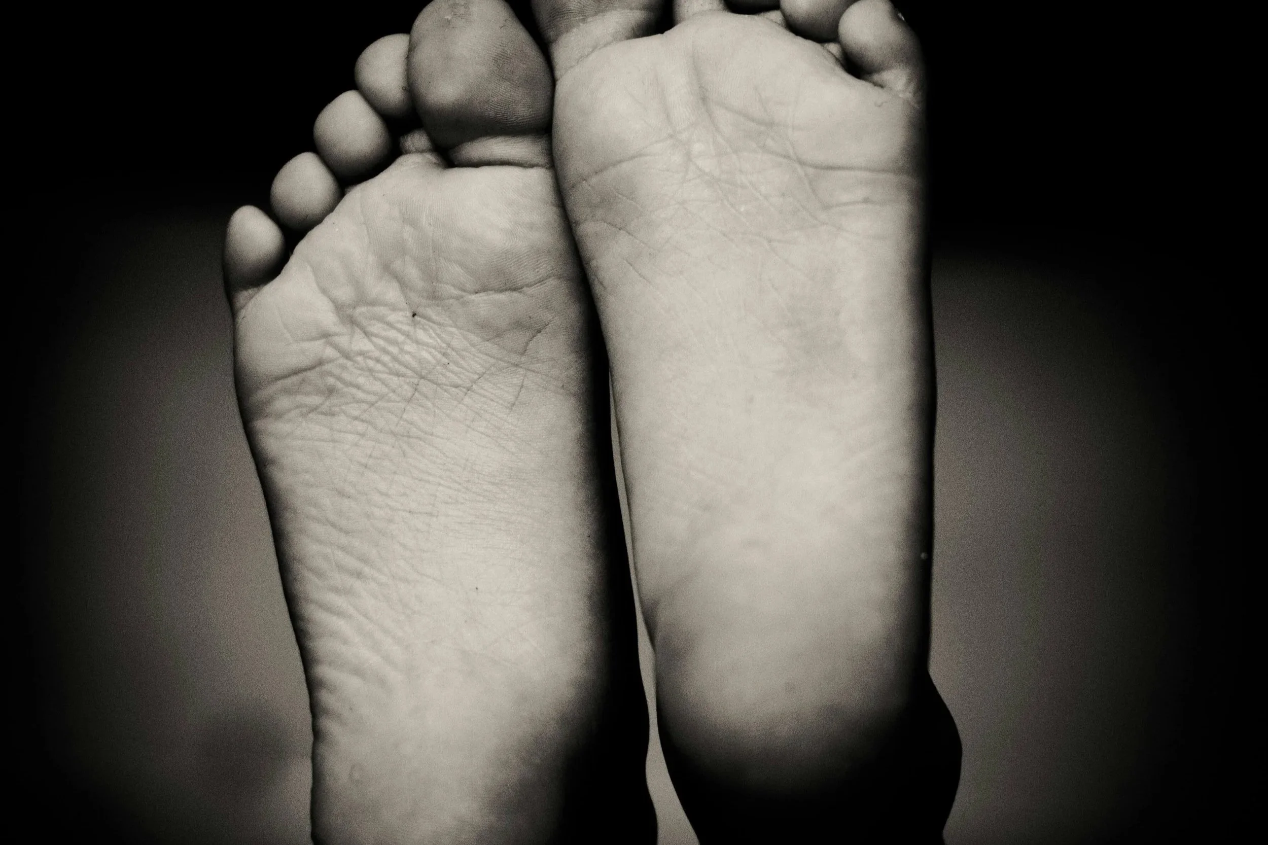 Why Plantar Fasciitis Often Comes Back Even When You Do Everything Right