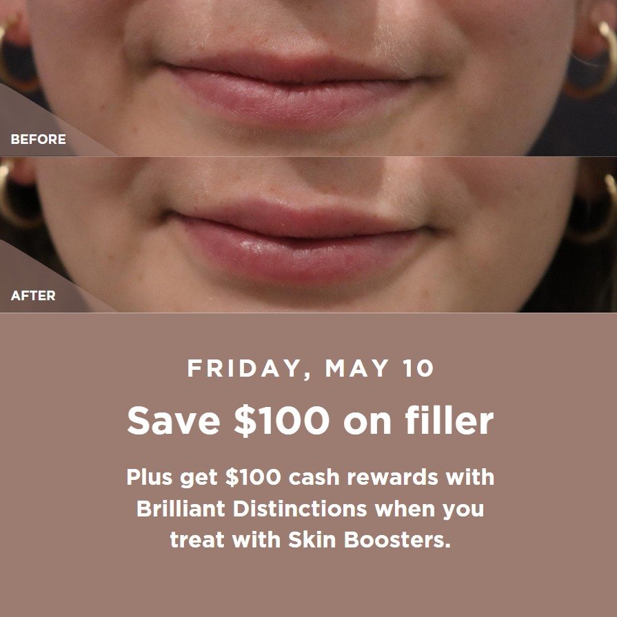 This Friday, May 10, book your filler treatment with Dr Constantin and save $100. Plus if you treat with Skin Boosters, you'll earn an extra $100 cash rewards with Brilliant Distinctions. Book online before spots are gone.