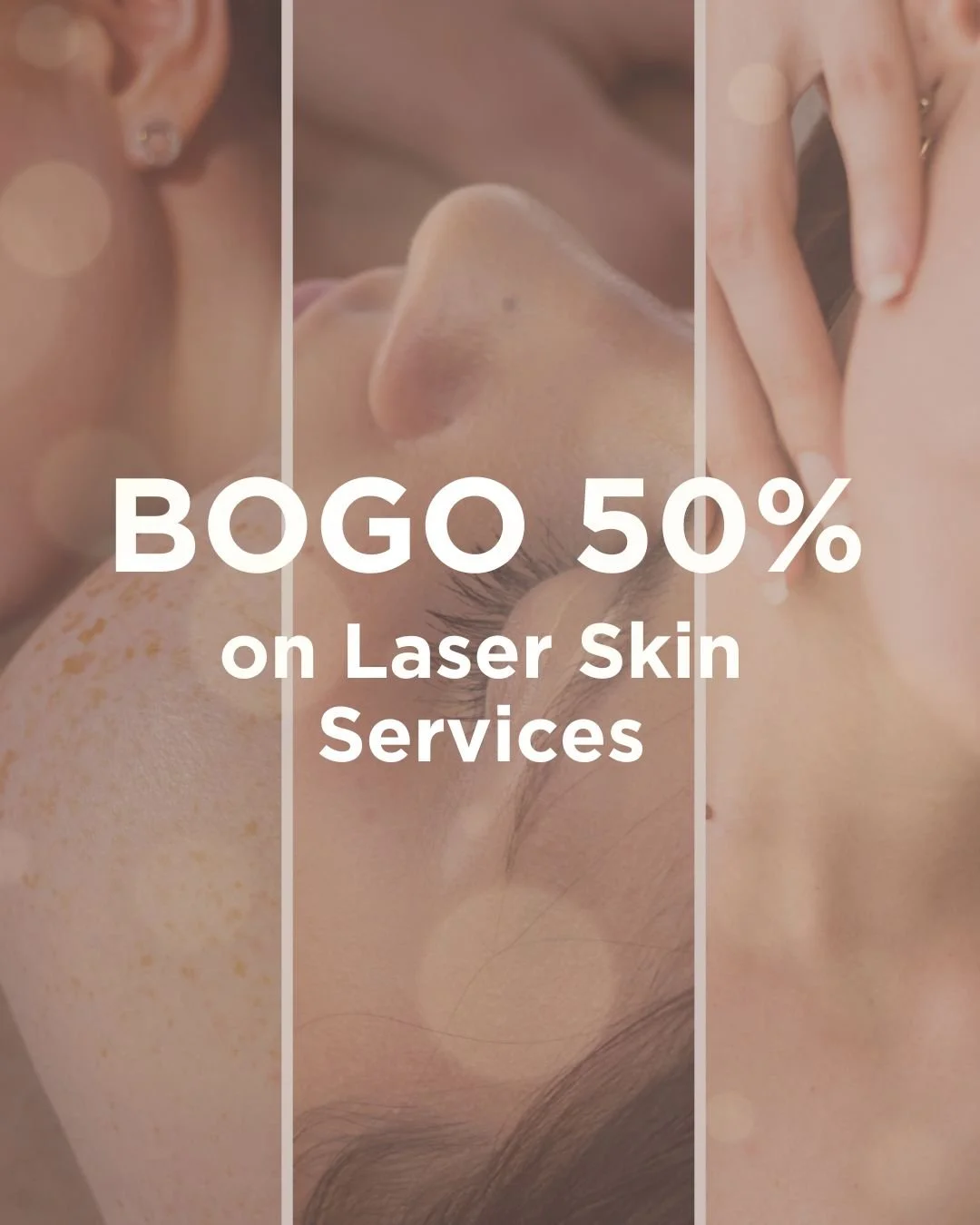 Take advantage of our Annual Laser BOGO &ndash; now through November 29!
Valid on IPL, RF Microneedling, and CO2 Resurfacing treatments.
Purchase one laser service and receive the 2nd at 50% off.
Available online and in-clinic
*Services must be used 