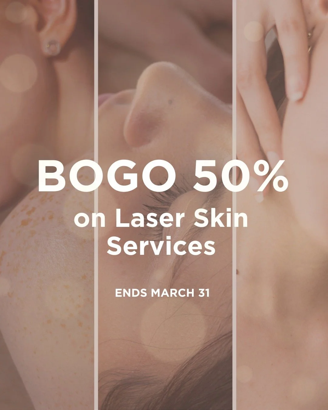 🌷 Spring refresh for your skin 🌷Buy one laser treatment and receive the second 50% off.

Includes IPL, RF Microneedling &amp; CO2.

Treatments can be purchased until March 31, 2026 and must be used by May 30, 2026.

Available online and in-clinic