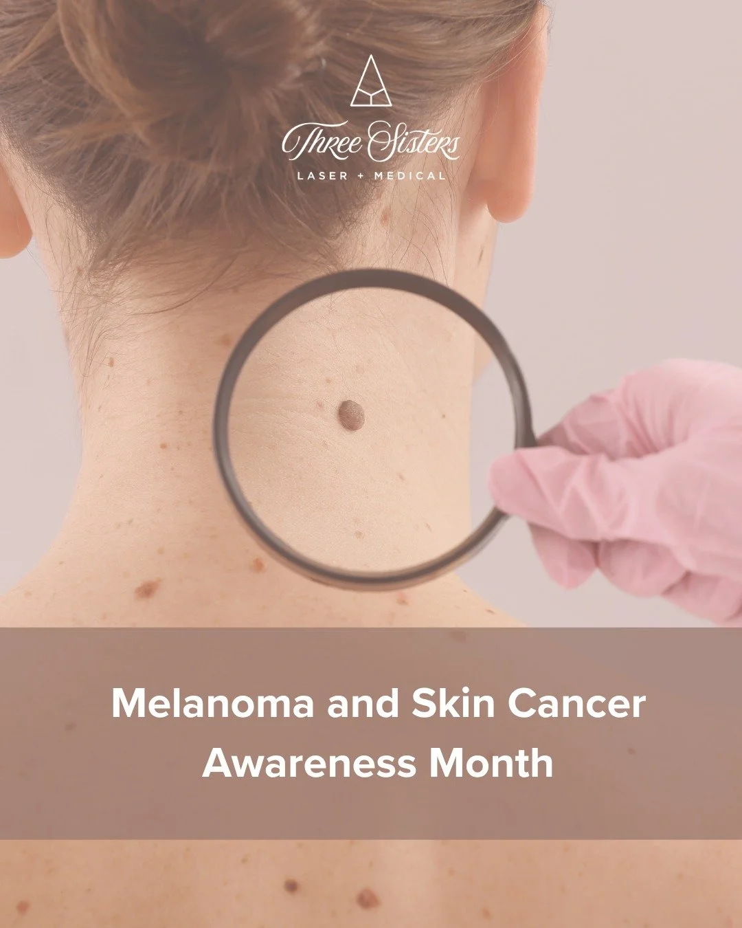 May is Melanoma &amp; Skin Cancer Awareness Month

If you notice a new or changing spot, don&rsquo;t ignore it &mdash; early detection is key.

Skin protection tips:

✔ Wear SPF 30+ daily
✔ Reapply sunscreen every 2 hours
✔ Avoid peak UV hours
✔ Wear