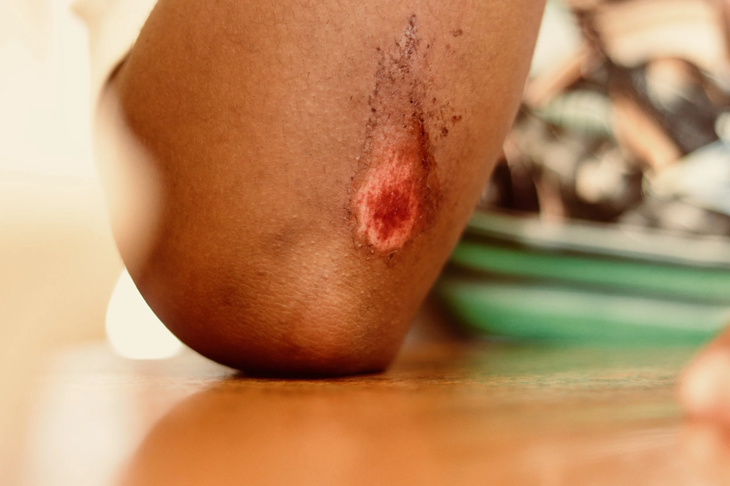 The House Sprung a Leak 