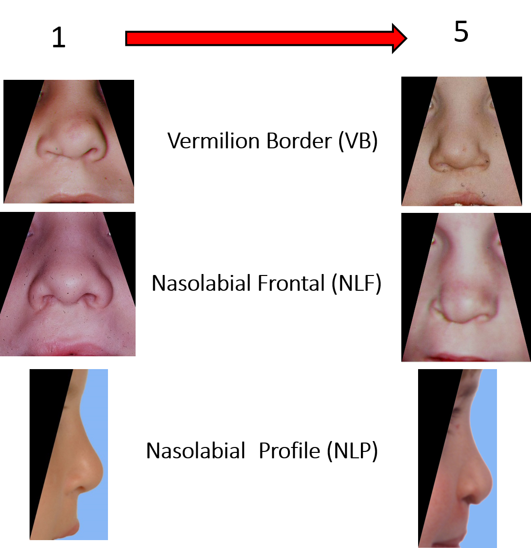 Nasolabial Appearance