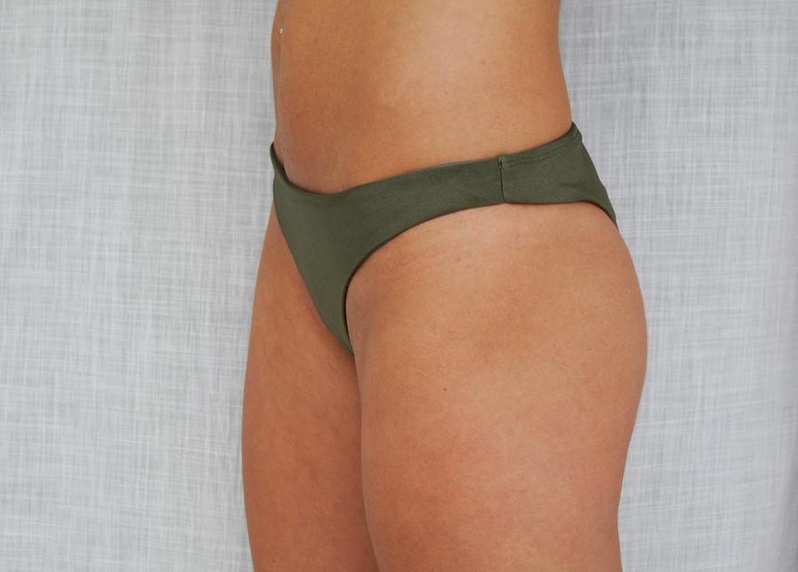 Lumi Forest Green Bikini Bottom.jpg