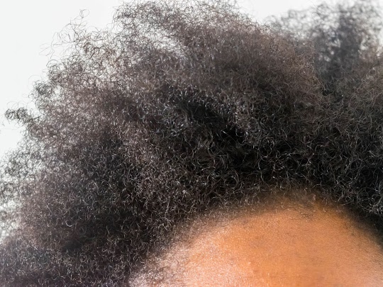 CCCA: Hair breakage can be the first sign of permanent hair loss.
