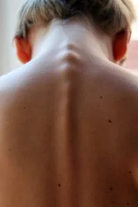spinal-column-246273