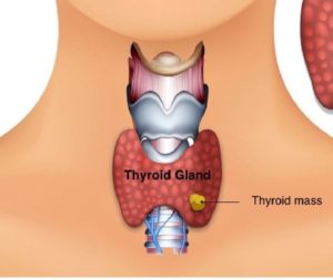 thyroid-and-parathyroid-1024x573