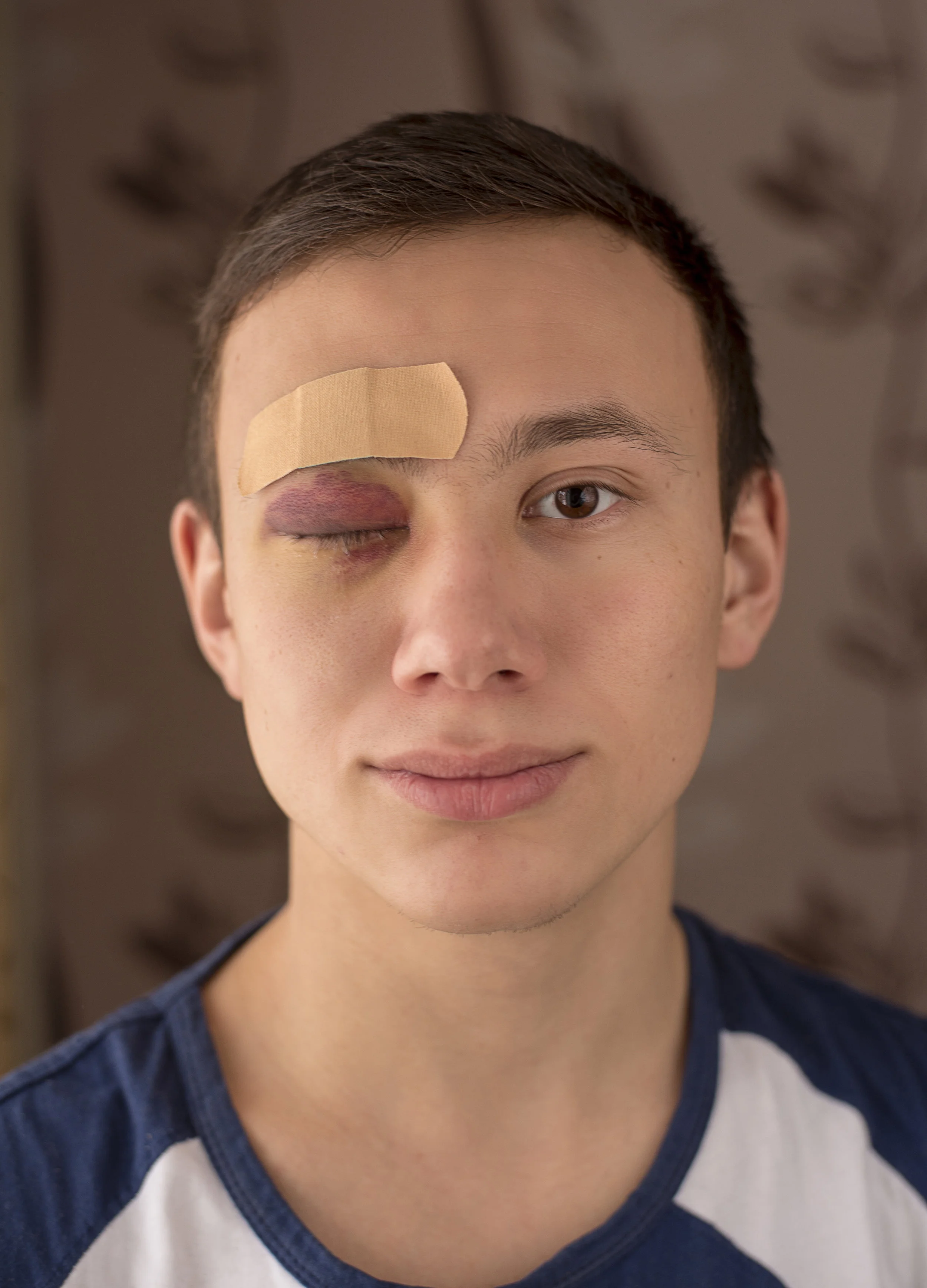 Head shot man with black eye and plaster