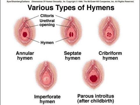 Smegma clitoris