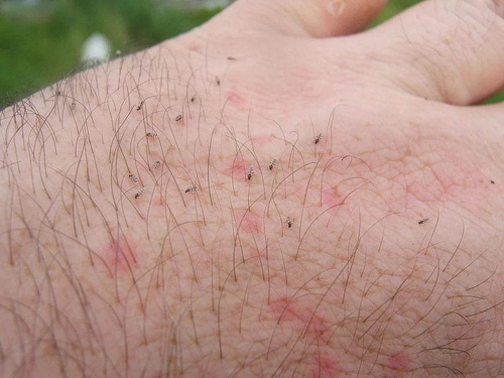 Flea Infestation Removal Services Water Orton.jpg