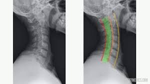 xrays pic.jpeg