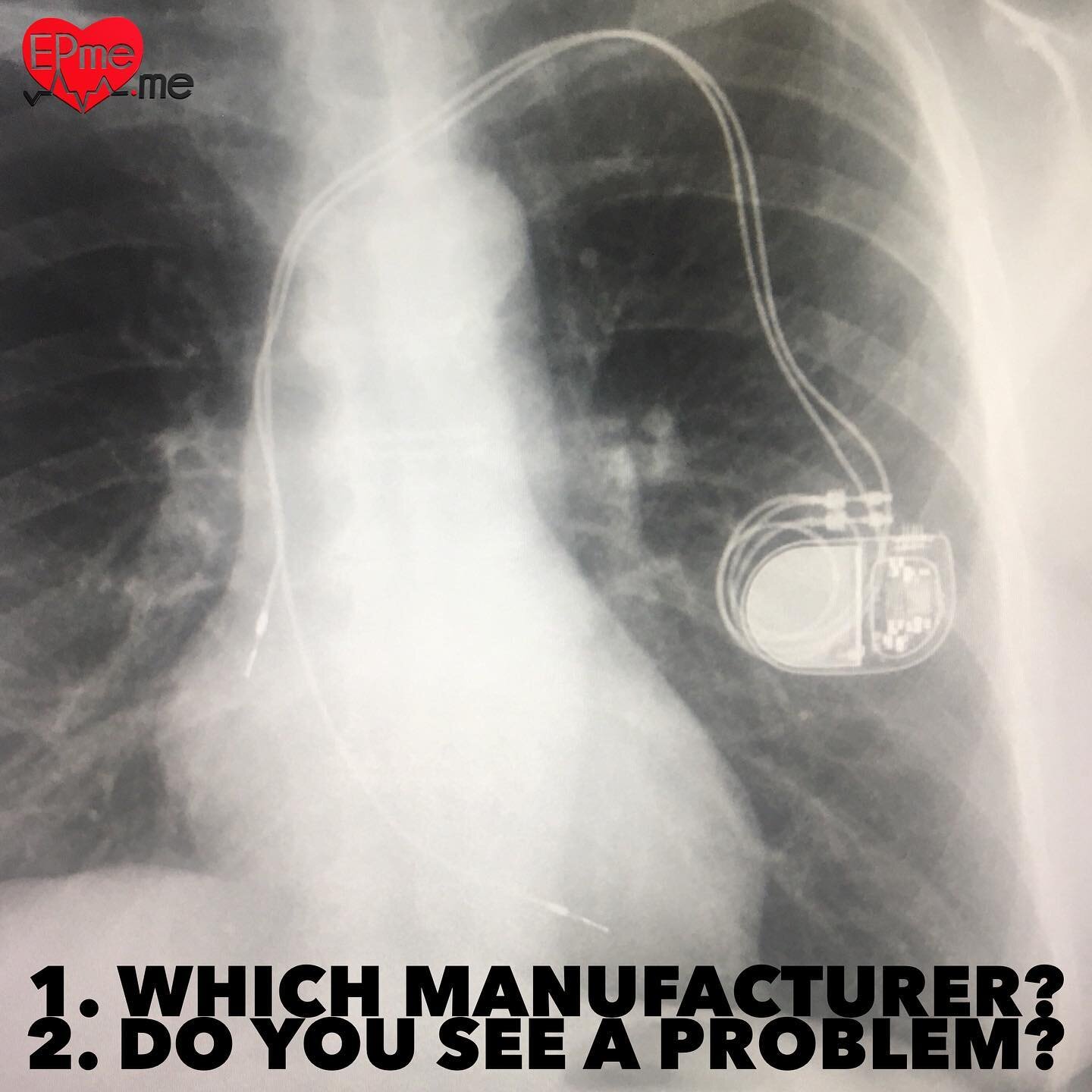 Which device manufacturer? Do you see a problem?
 #pacing #cardiology #cardiologynurse
#electrophysiology #ekg #ecg #heart
#heartrhythm #eps #ep #health
#medstudent #med #medic #medicine
#medical #catheterization #ablation
#cardiacablation #icd #defi