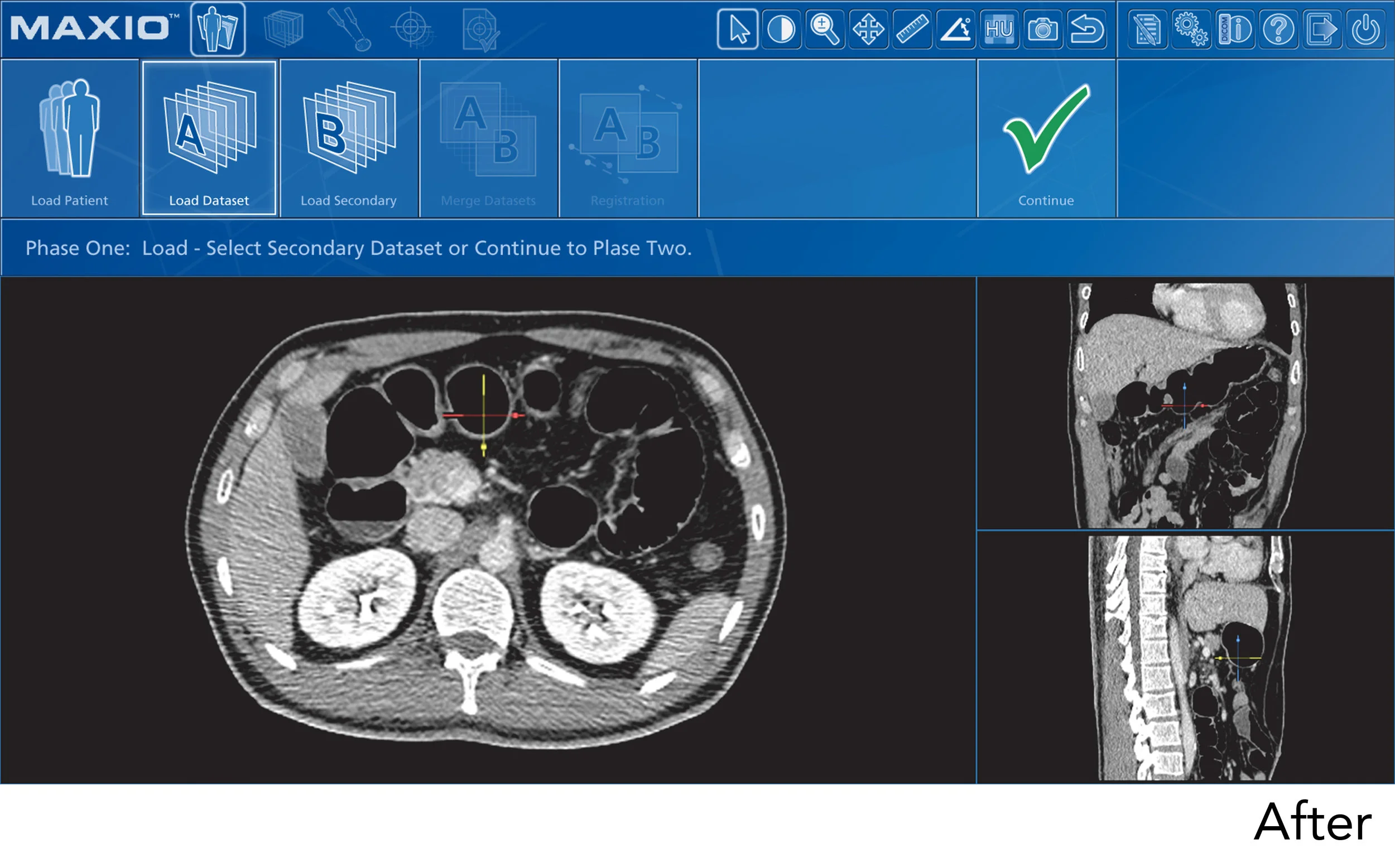 GUI Screenshot - After02.jpg