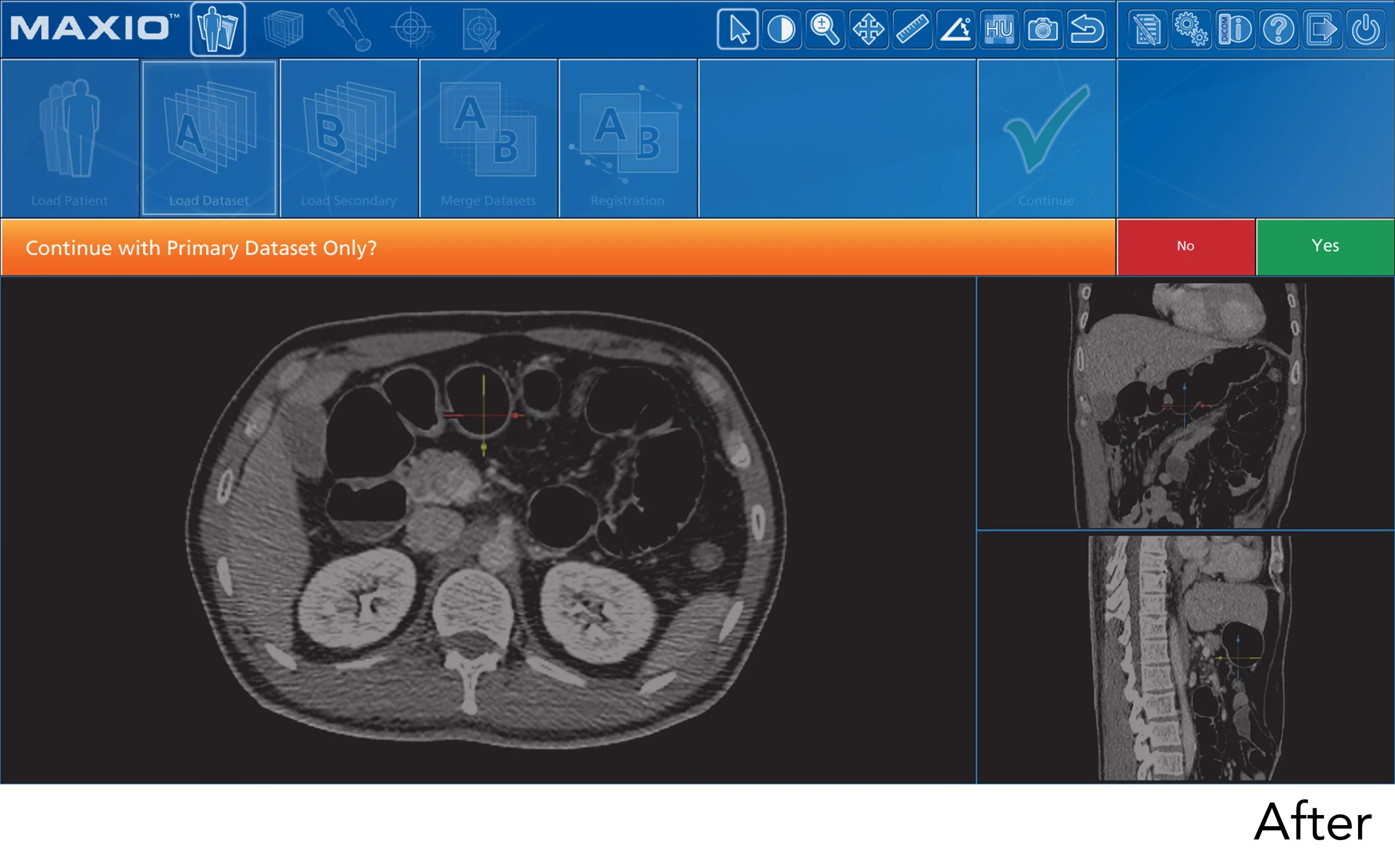 GUI Screenshot - After03.jpg