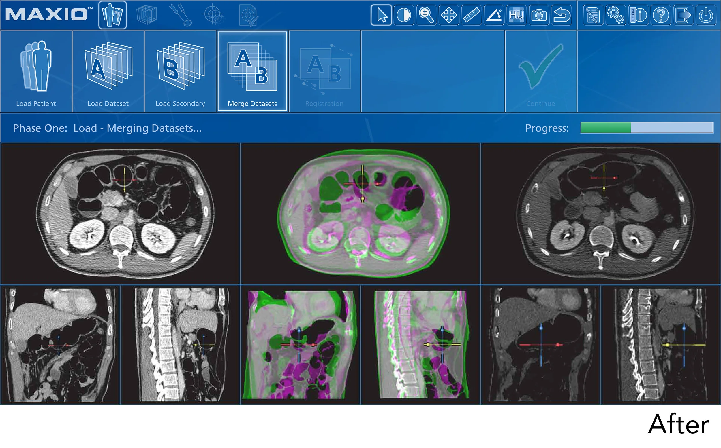 GUI Screenshot - After04.jpg