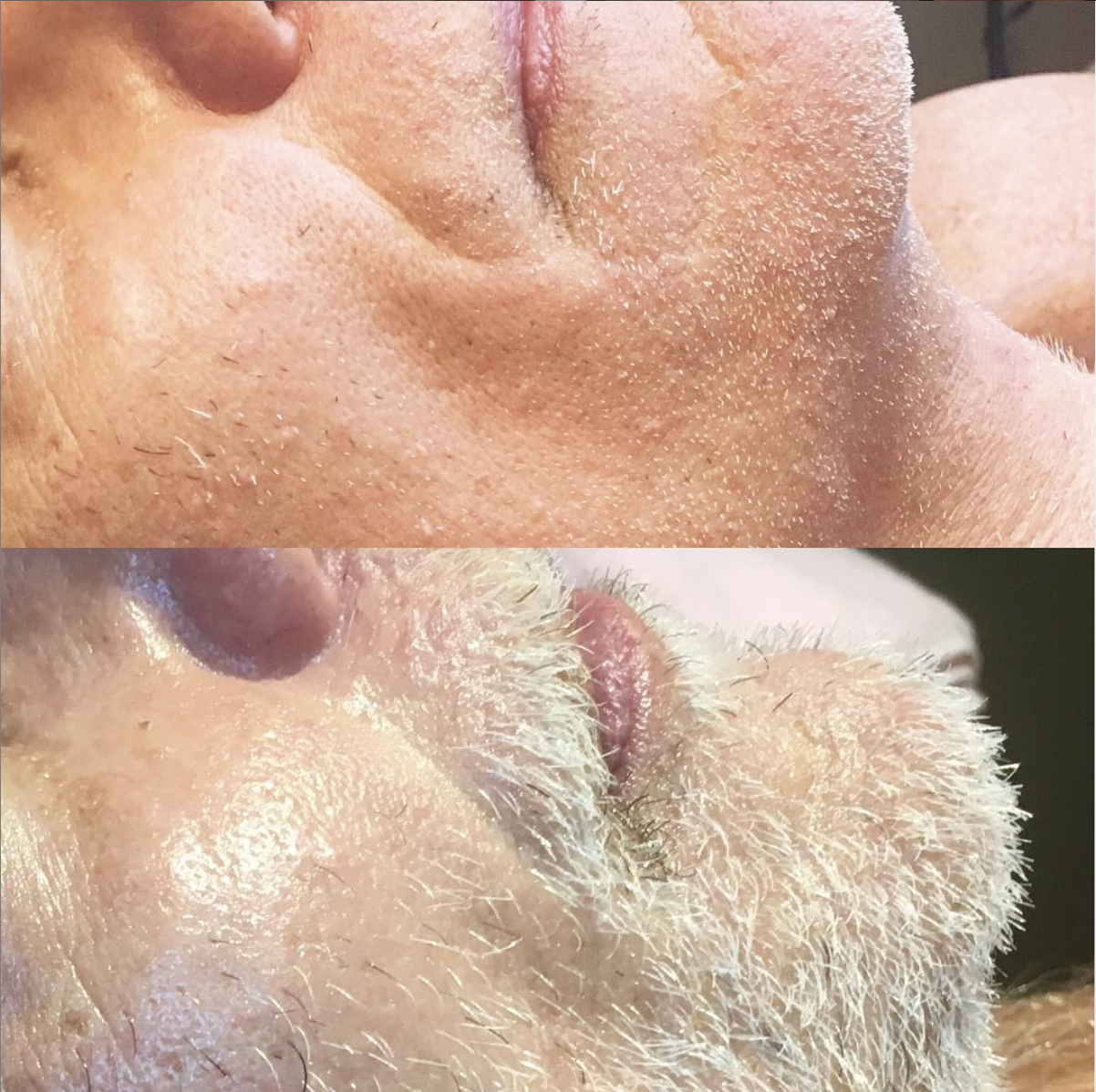 Before - After